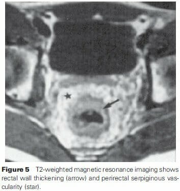 T2-weighted magnetic resonance imaging