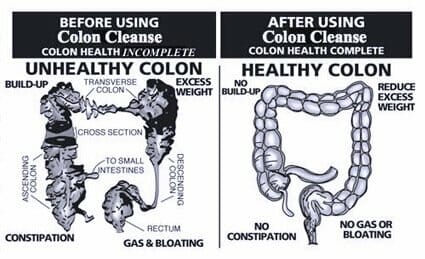 Colon Cleansing Colon Cleansing