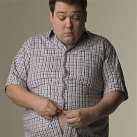 The Obesity Factor of Colorectal Cancer Risk