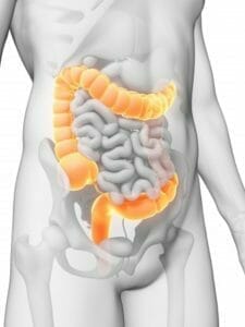 Will the New FDA-Approved PillCam Help Make Colonoscopies Easier in the Future?