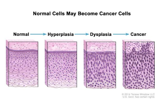 Normal Cells may become Cancer Cells